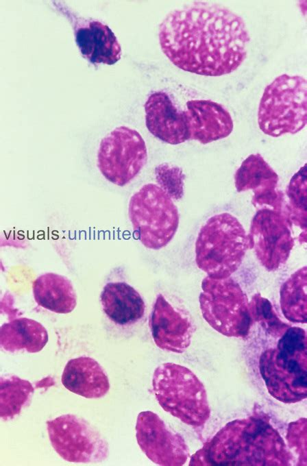 chlamydia bacteria gram stain|Chlamydia Trachomatis Infections: Screening, Diagnosis, and.